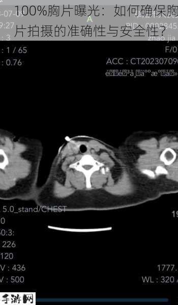 100%胸片曝光：如何确保胸片拍摄的准确性与安全性？